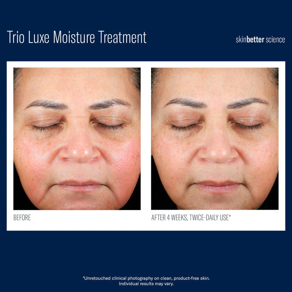 SkinBetter Trio Luxe Moisture Treatment