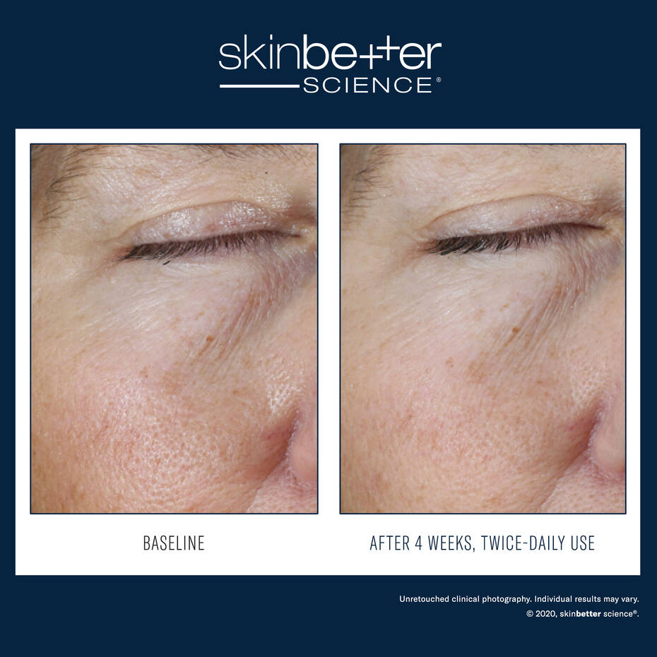 SkinBetter Instant Effect Gel Eye