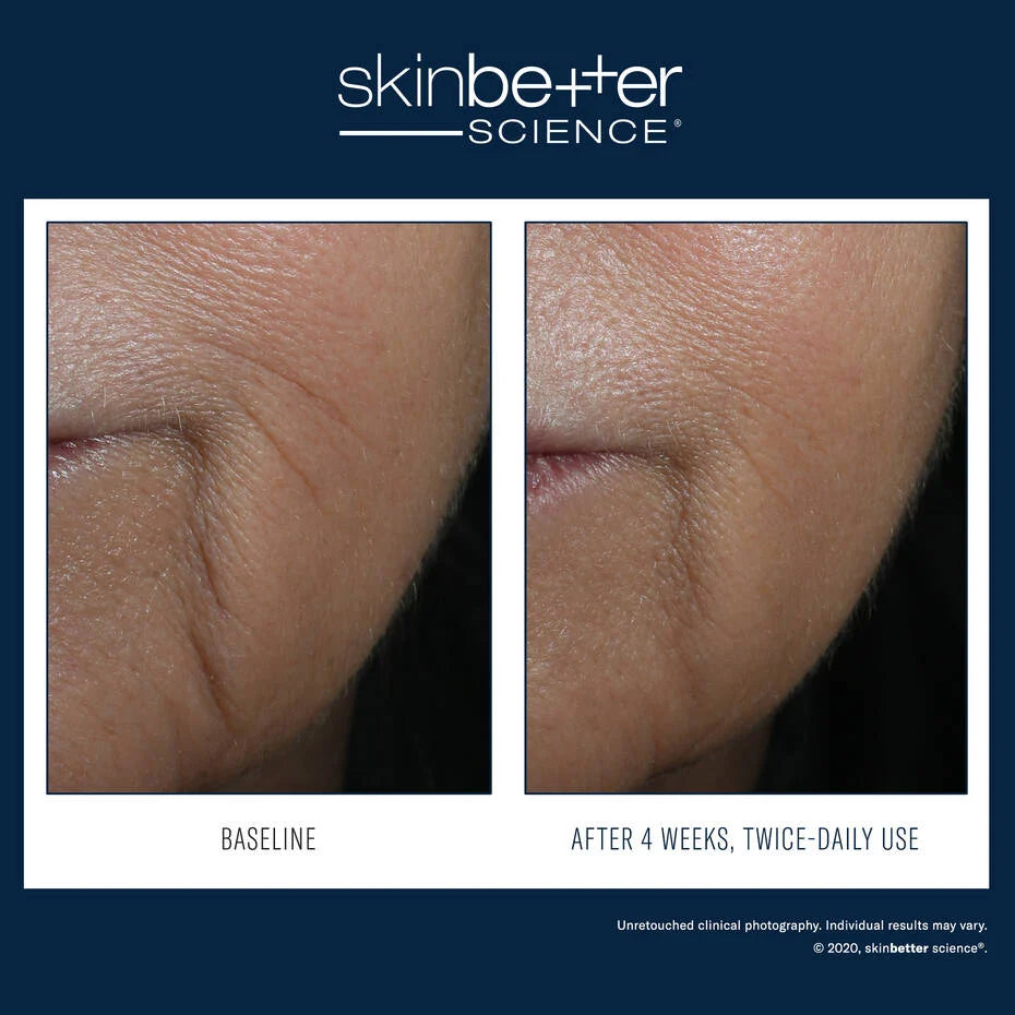 Skinbetter Interfuse Face and Neck Cream