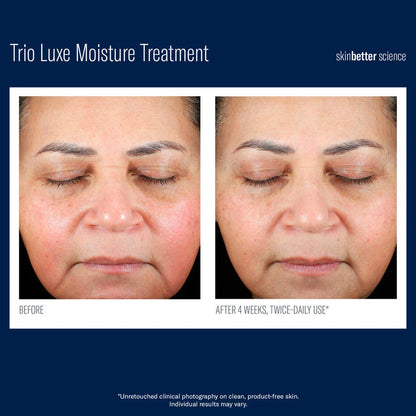 SkinBetter Trio Luxe Moisture Treatment