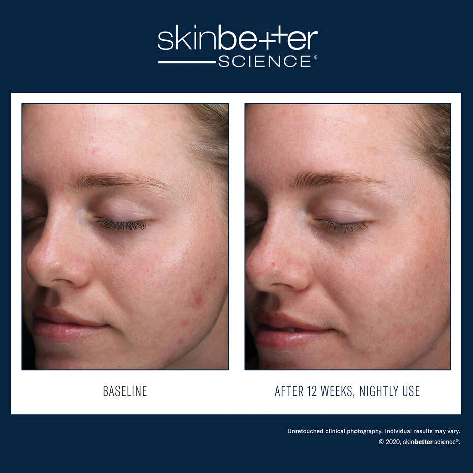 SkinBetter AlphaRet Clearing Serum