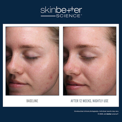 SkinBetter AlphaRet Clearing Serum