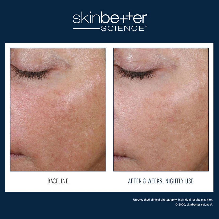 SkinBetter Alpharet Overnight Cream