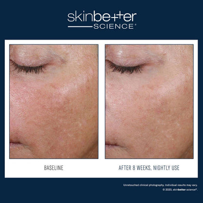 SkinBetter Alpharet Overnight Cream