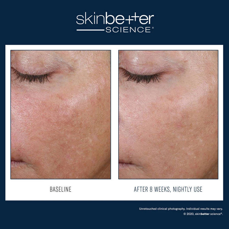 SkinBetter Alpharet Overnight Cream