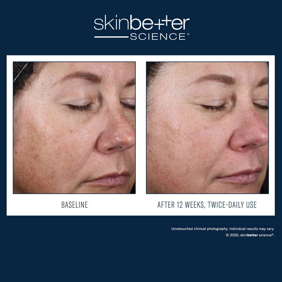 SkinBetter Alto Advanced Defense Repair Serum