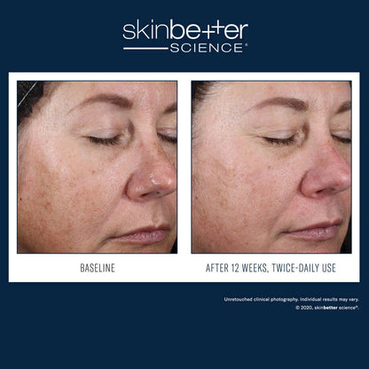 SkinBetter Alto Advanced Defense Repair Serum