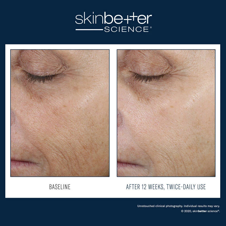 SkinBetter Even Tone Correcting Serum