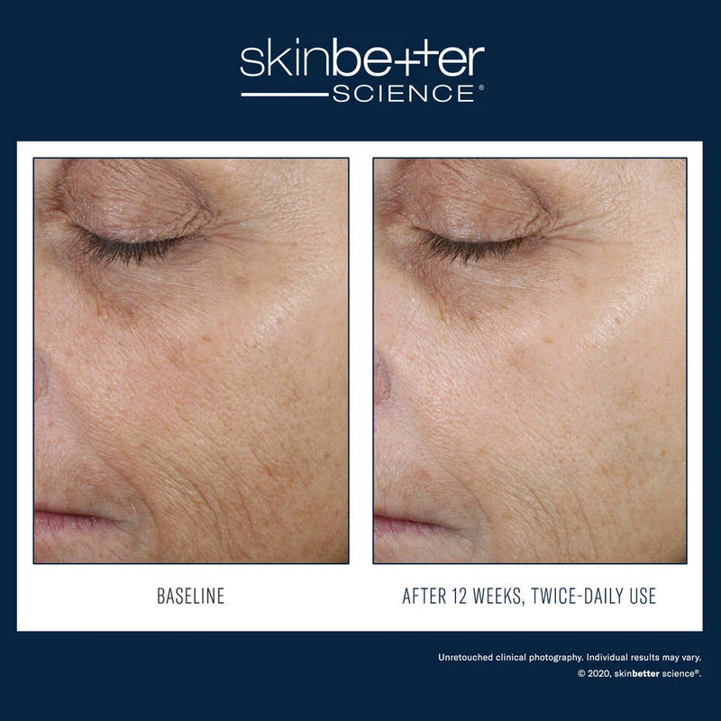 SkinBetter Even Tone Correcting Serum