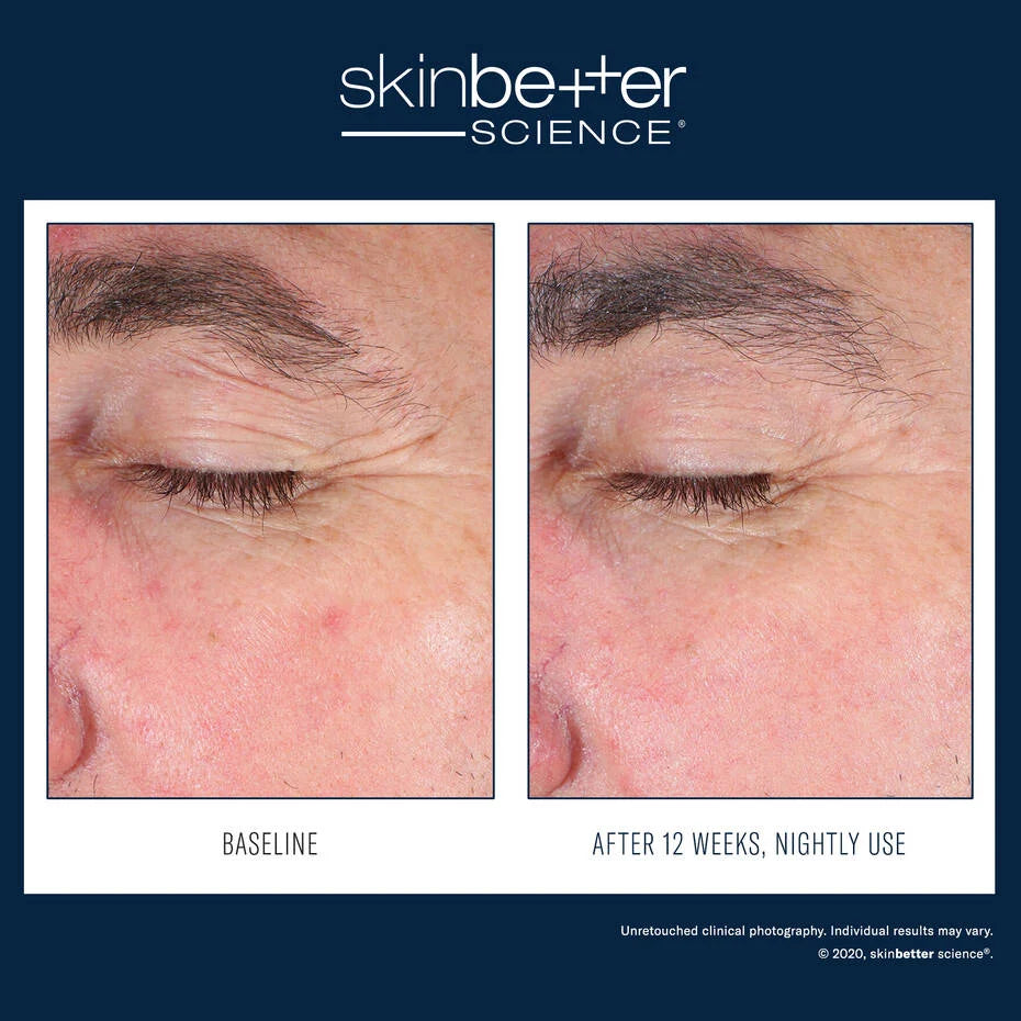 SkinBetter EyeMax Alpha Overnight Cream