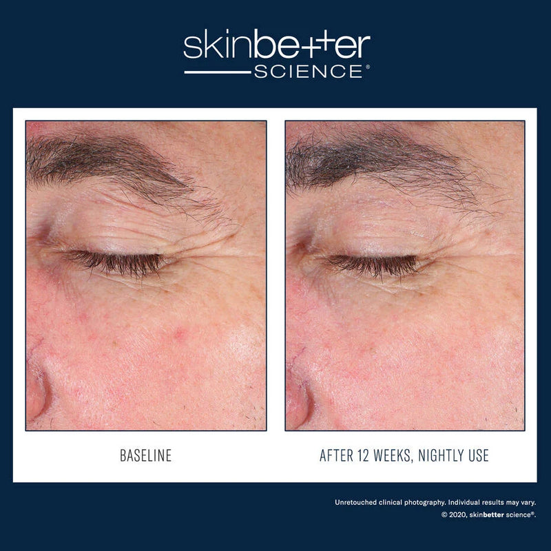 SkinBetter EyeMax Alpha Overnight Cream