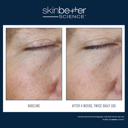 SkinBetter Instant Effect Gel Eye
