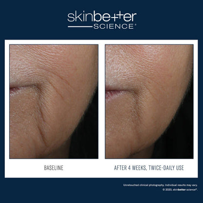 Skinbetter Interfuse Face and Neck Cream