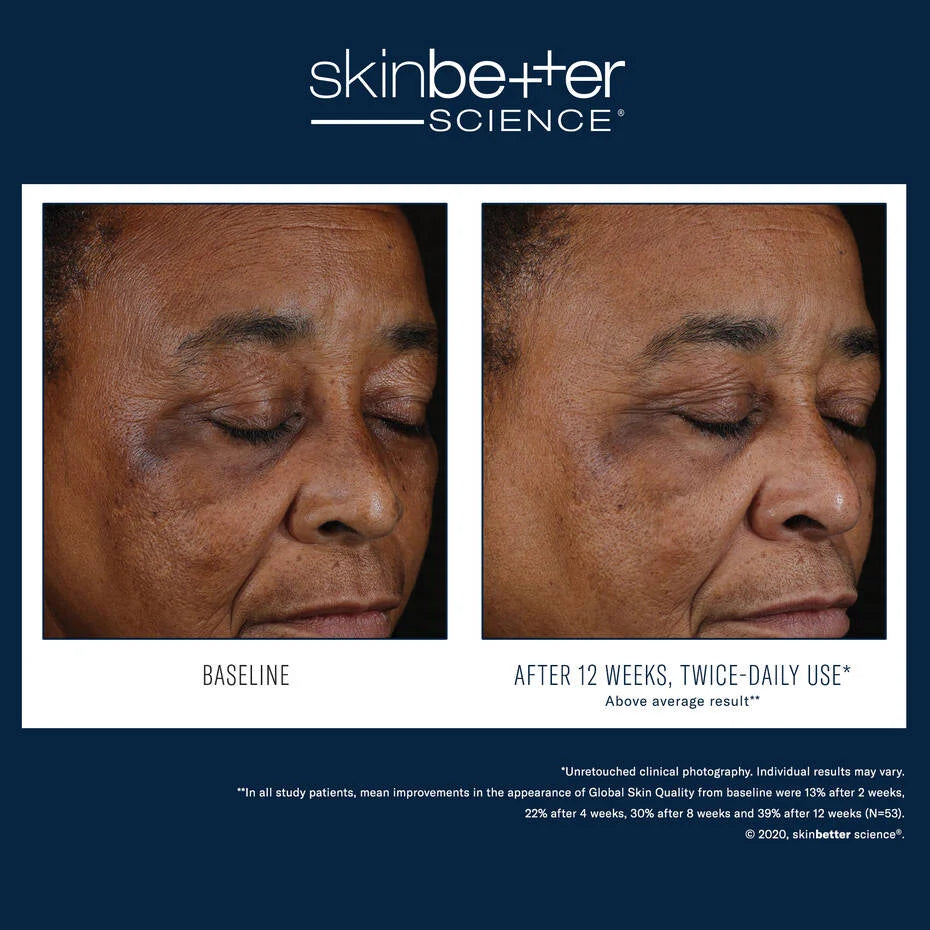 SkinBetter Mystro Active Balance Serum