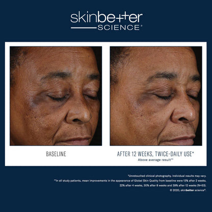 SkinBetter Mystro Active Balance Serum